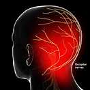 occipital-neuralgia