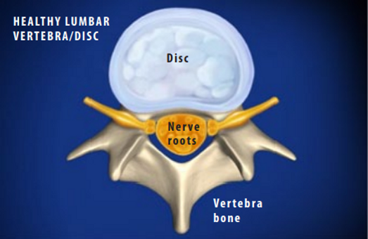 healthy-lumbar-vertebra