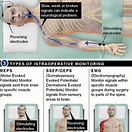 intraoperative-monitoring-of-the-nerves