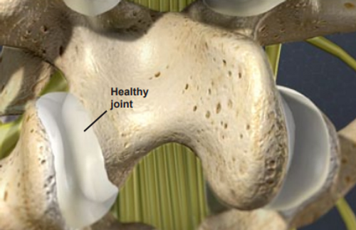 healthy-joint