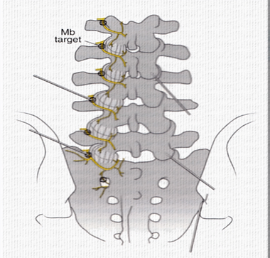 facet-joint-medial-branches
