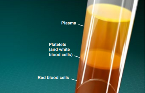 prp-therapy-for-chronic-knee-pain