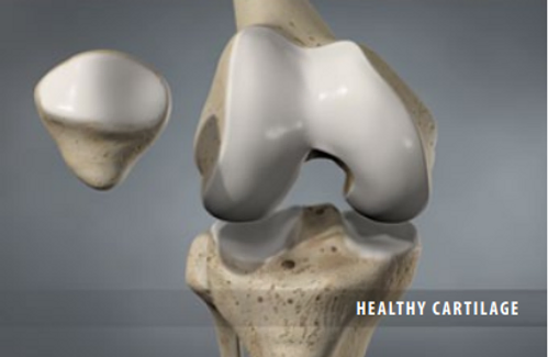 healthy-cartilage