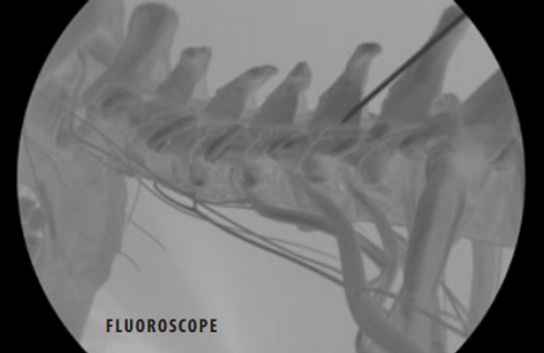 fluoroscope