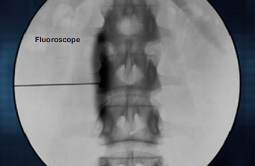 fluoroscope