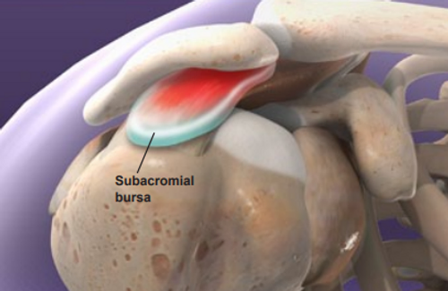 causes-of-shoulder-impingement-syndrome