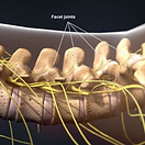 facet-joint-injections