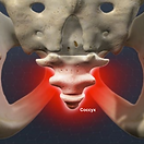 coccydynia