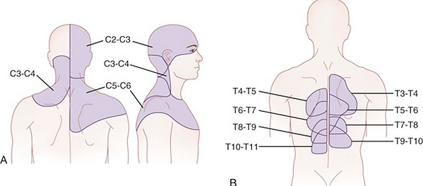 cervicogenic-headaches