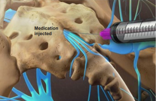 medication-injected
