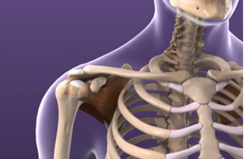 shoulder-impingement-syndrome