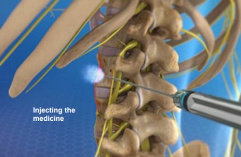 injecting-the-medicine