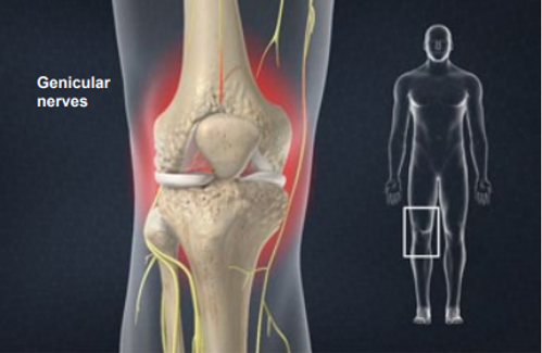 genicular-nerve