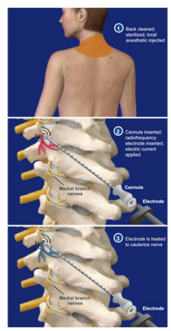 chiropractic-pain