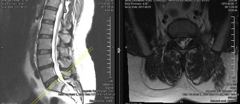 spine-and-pain