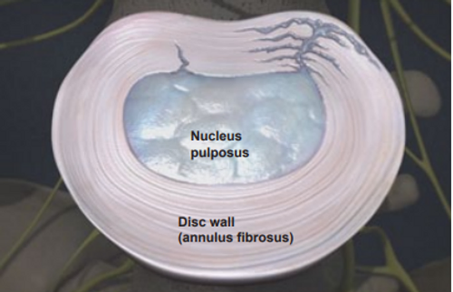 disc-wall-heals