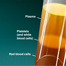 prp-therapy