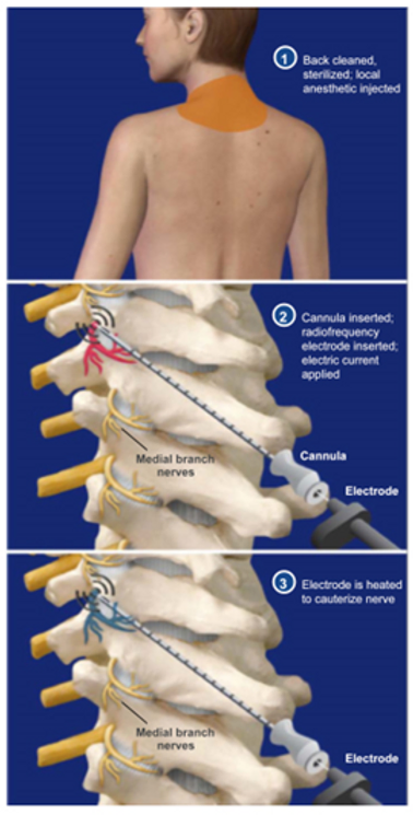 spine-structures​