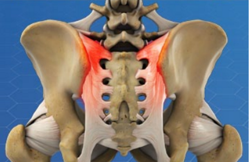 sacroiliac-joint-pain