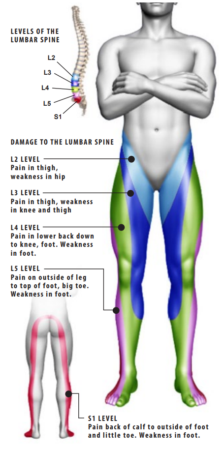 spinal-stenosis