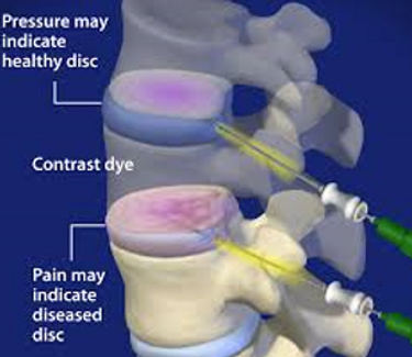 chiropractic-&-pain