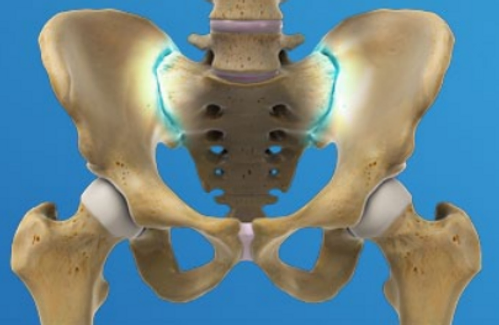 symptoms-of-sacroiliac-joint-pain