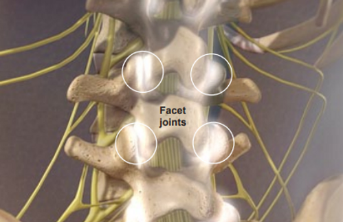 facet-joint