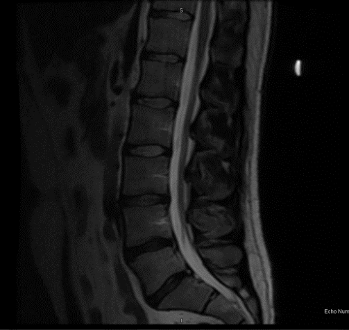 chiropractic-pain