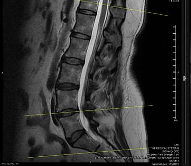 chiropractic-&-pain