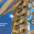 lumbar-sympathetic-block