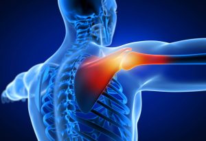 shoulder pain causes