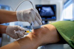 Ultrasound-guided PRP injection at patient knee