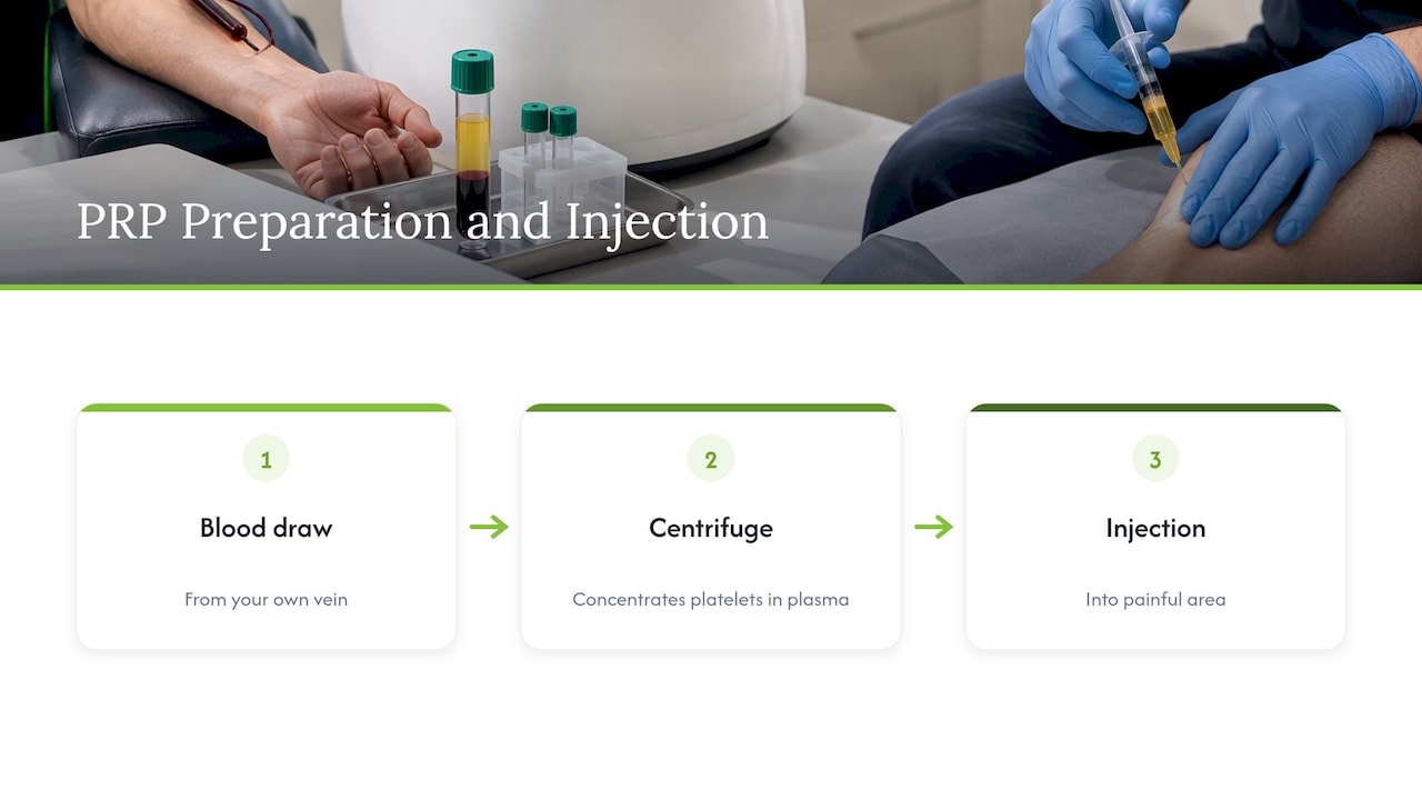 Three steps showing how PRP is prepared and injected